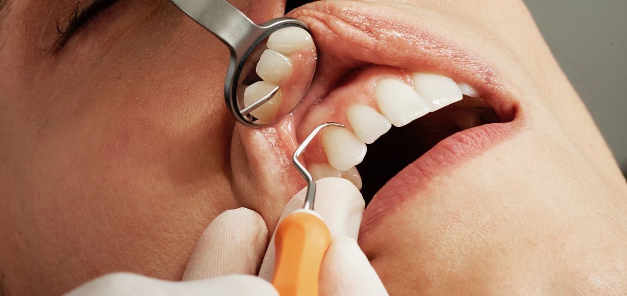 Les Dents Artificielles Sont En Céramique Pour Le Patient Banque D'Images  et Photos Libres De Droits. Image 183850258