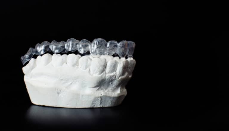 Orthodontie invisible Paris 8, Appareil Invisalign | Gouttière dentaire